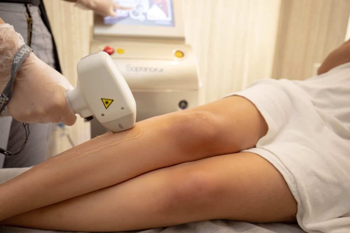 soprano-ice-epilation.jpeg